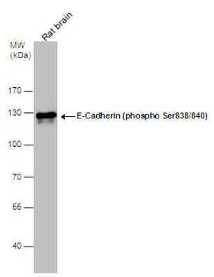 Western Blot: E-Cadherin [p Ser838, p Ser840] Antibody [NBP3-12922]
